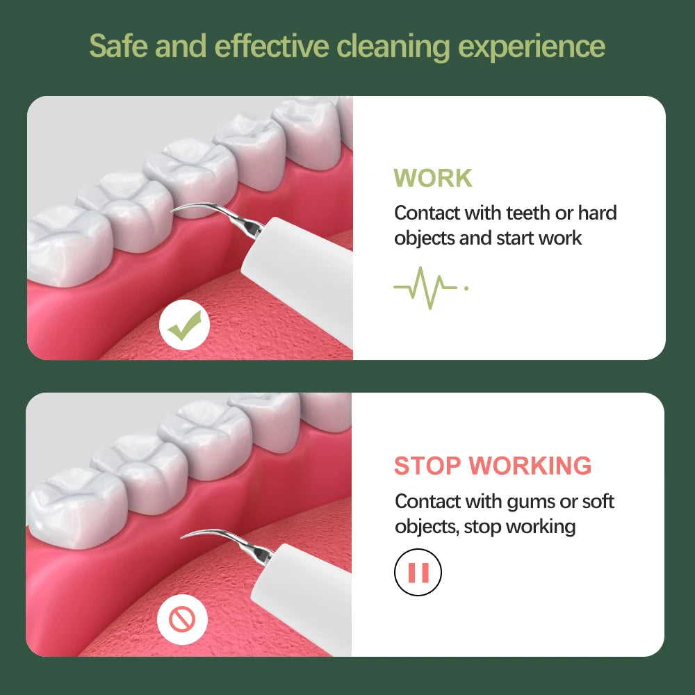 Visual Ultrasonic Tooth Cleaner Electric Dental Scaler Calculus Tartar Remover Teeth Whitening With Camera Teeth Cleaner Tools