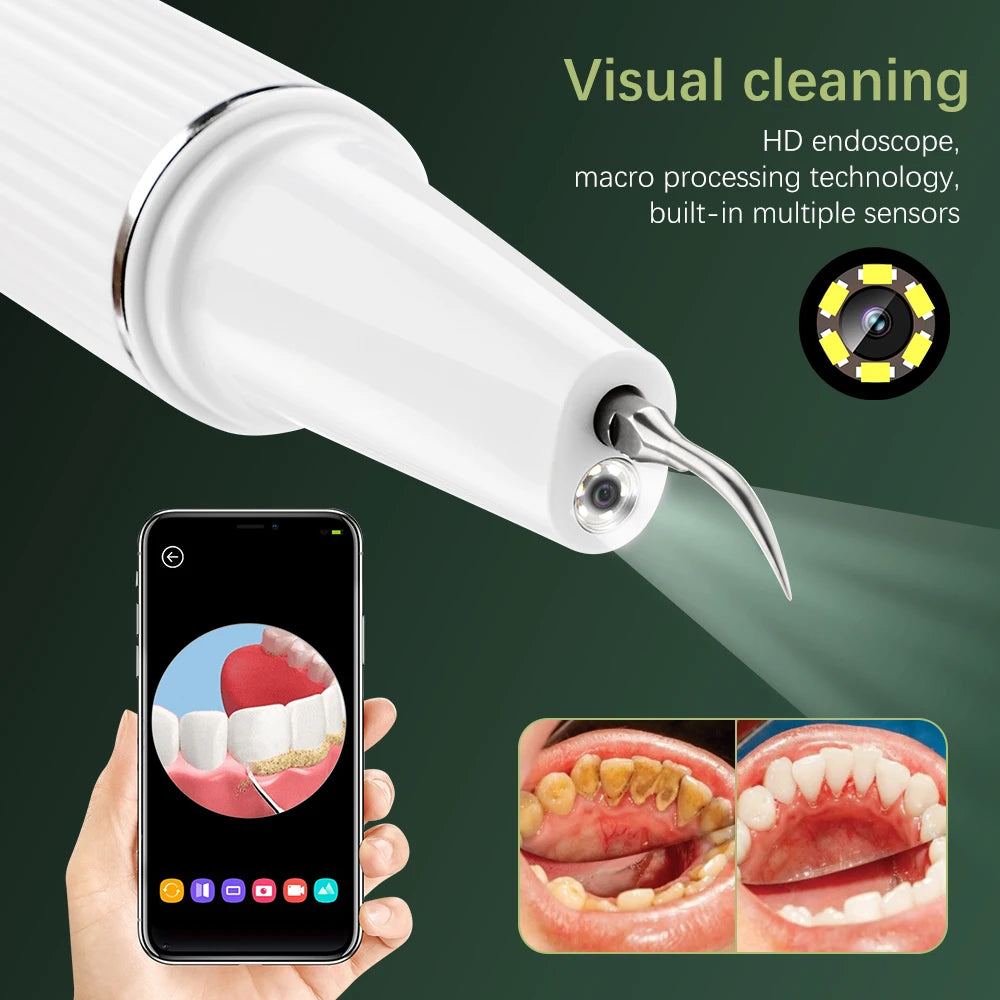 Visual Ultrasonic Tooth Cleaner Electric Dental Scaler Calculus Tartar Remover Teeth Whitening With Camera Teeth Cleaner Tools