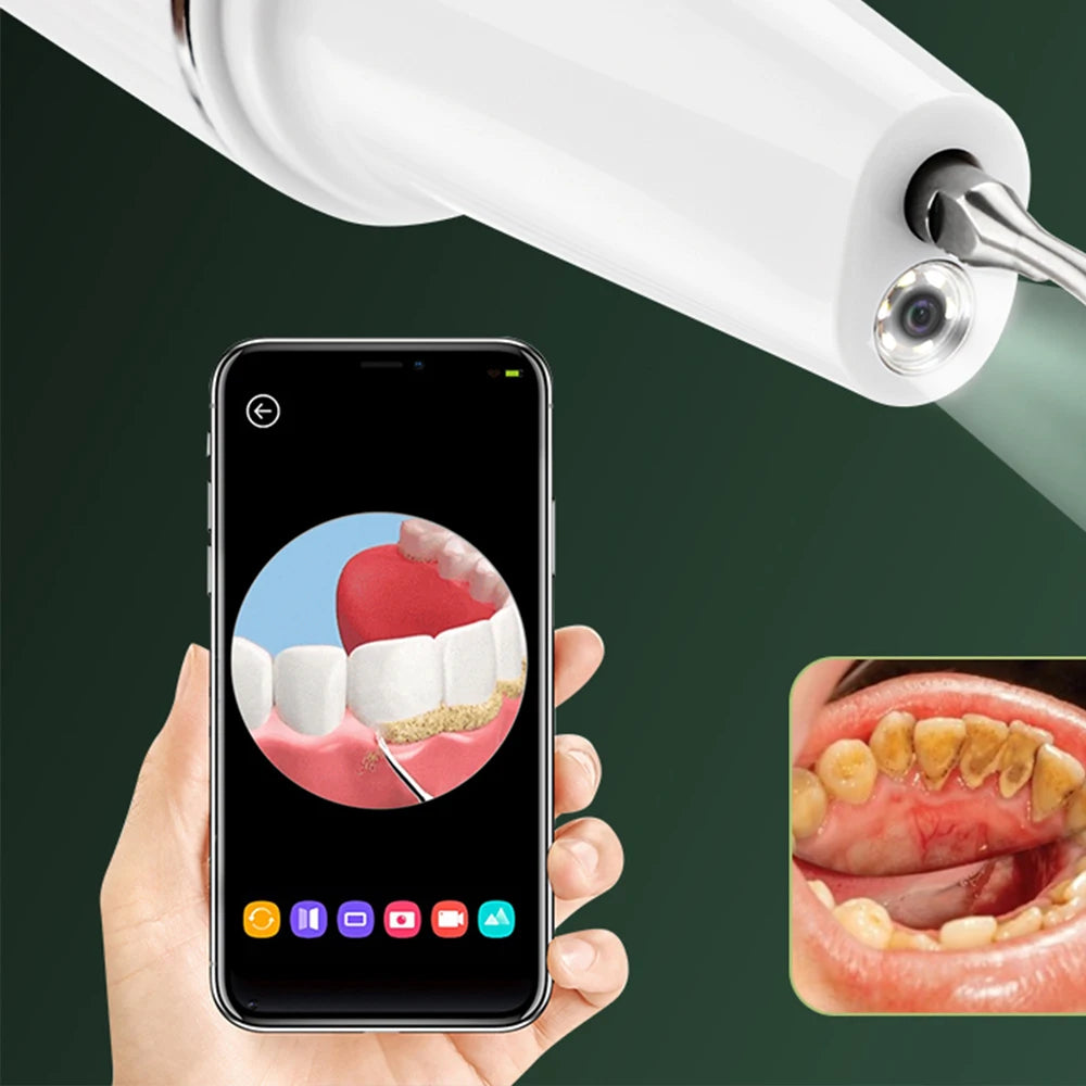 Visual Ultrasonic Tooth Cleaner Electric Dental Scaler Calculus Tartar Remover Teeth Whitening With Camera Teeth Cleaner Tools
